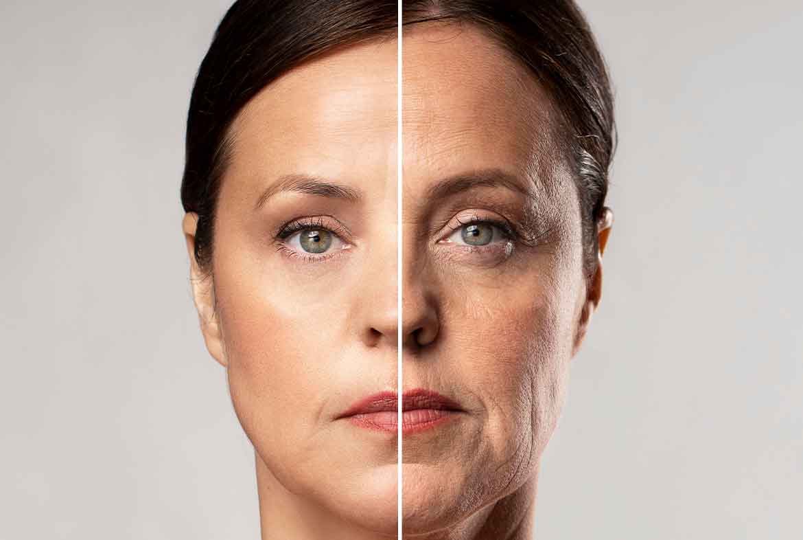 facelift-surgery