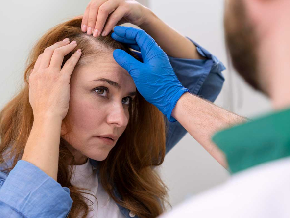 women-hair-transplantation